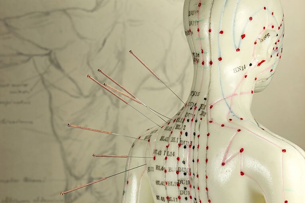 benefits of acupuncture